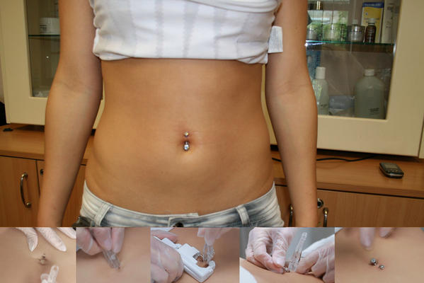 Köldök piercing belövés, steril nikkelmentes ékszerrel www.koldokpiercingbeloves.hu